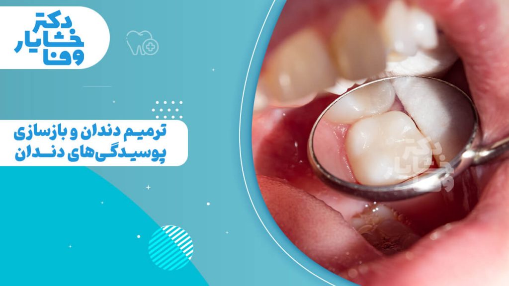 تصویر گرافیکی با پس‌زمینه آبی روشن و متن فارسی. متن اصلی "ترمیم دندان و بازسازی پوسیدگی‌های دندان" است. در سمت راست، یک تصویر نزدیک از داخل دهان، یک دندان آسیاب ترمیم‌شده با پرکردگی سفید (کامپوزیت) را نشان می‌دهد که توسط آینه دندانپزشکی منعکس شده است. لوگوی "دکتر خشایار وفا" در گوشه بالا و سمت چپ قرار دارد.