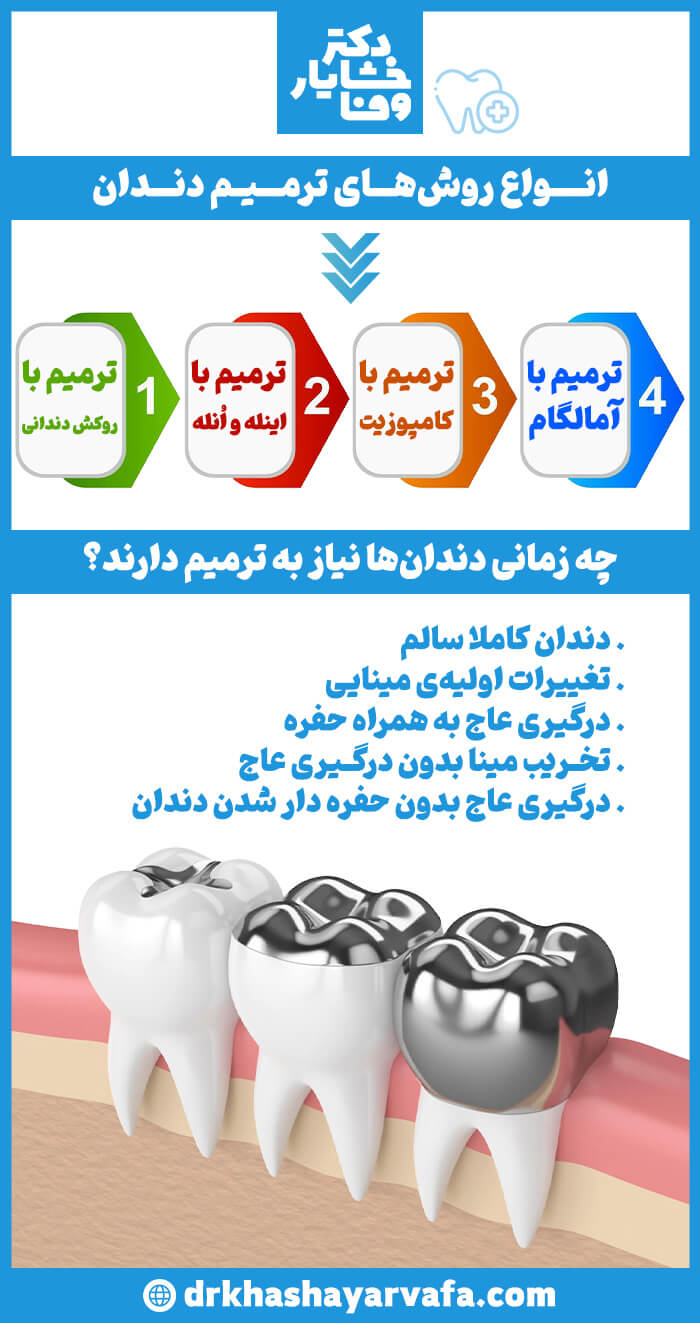 اینفوگرافیک عمودی با پس‌زمینه آبی و سفید در مورد ترمیم دندان. بخش اول "انواع روش‌های ترمیم دندان" را با شماره‌گذاری و فلش رو به پایین نشان می‌دهد: ۱) ترمیم با روکش دندانی، ۲) ترمیم با اینله و انله، ۳) ترمیم با کامپوزیت، ۴) ترمیم با آمالگام. بخش دوم سؤال "چه زمانی دندان‌ها نیاز به ترمیم دارند؟" را مطرح کرده و چندین مورد را لیست کرده است. در پایین تصویر، یک نمای برش عرضی از دندان‌ها، دندان‌هایی را که با پرکردگی آمالگام (فلزی) ترمیم شده‌اند، به تصویر می‌کشد.