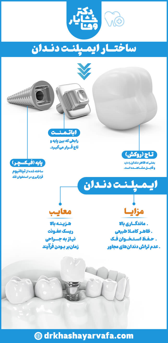اینفوگرافیک ساختار و مزایا و معایب ایمپلنت دندان، اجزای ایمپلنت پایه اباتمنت روکش، مزایا و معایب ایمپلنت، دکتر خشایار وفا