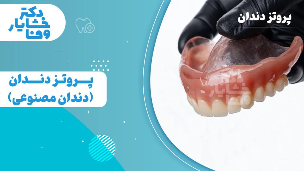 تصویر پروتز دندان (دندان مصنوعی کامل) که توسط دندانپزشک گرفته شده است، راهنمای انواع دندان مصنوعی متحرک و ثابت.