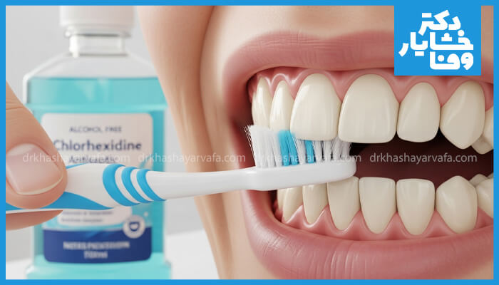 مسواک زدن ملایم دندان‌ها با مسواک نرم در کنار بطری دهانشویه کلرهگزیدین بدون الکل.