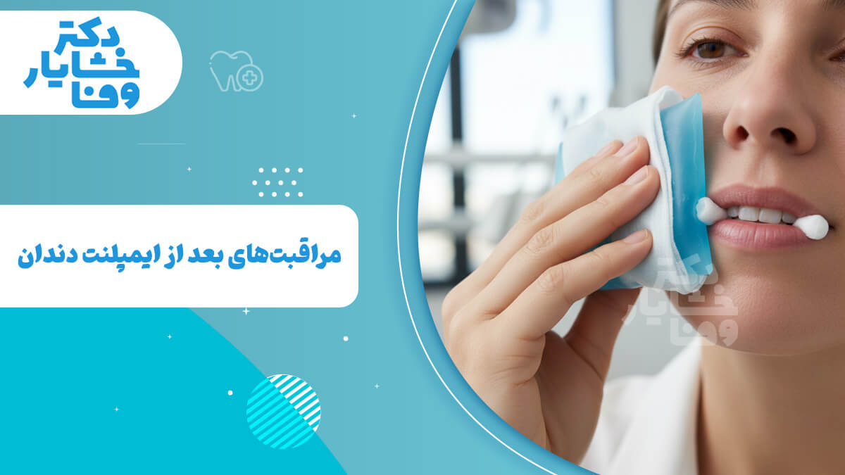 مراقبت‌های بعد از ایمپلنت دندان با نمایش فردی که کمپرس سرد (یخ) و گاز استریل را روی ناحیه جراحی شده نگه داشته است.