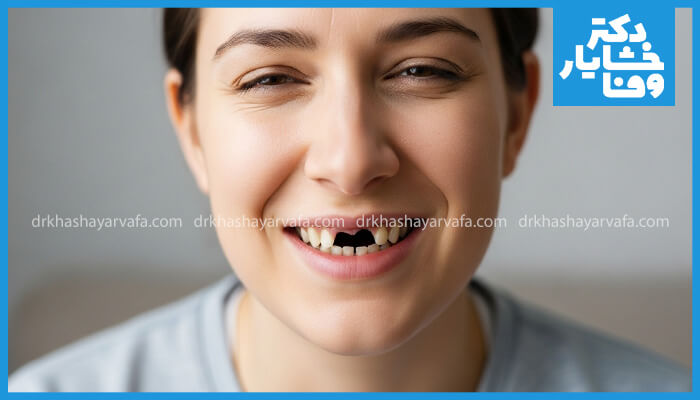 تصویری از یک خانم با دندان از دست رفته در جلوی دهان، مناسب برای نمایش قبل از درمان