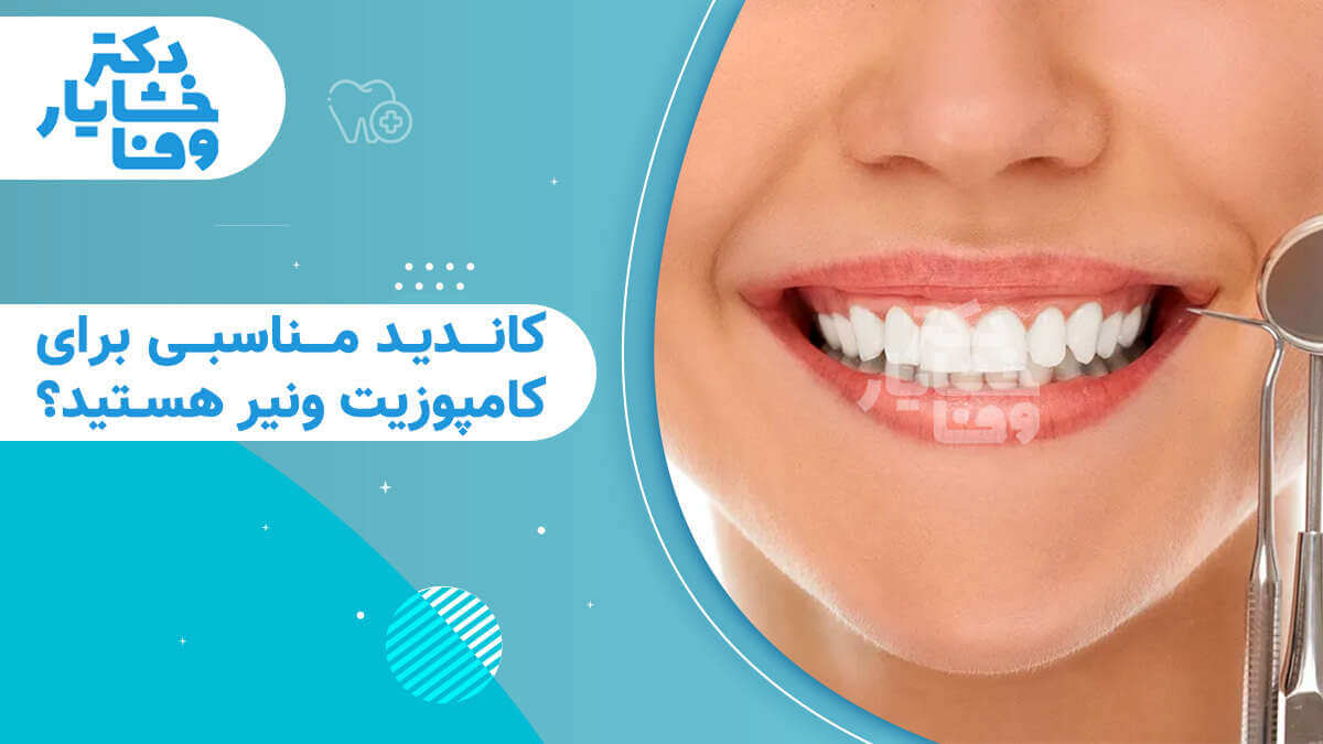 تصویر بنر با عنوان "آیا کاندید مناسبی برای کامپوزیت ونیر هستید؟" شامل نمای لبخند و ابزار دندانپزشکی.