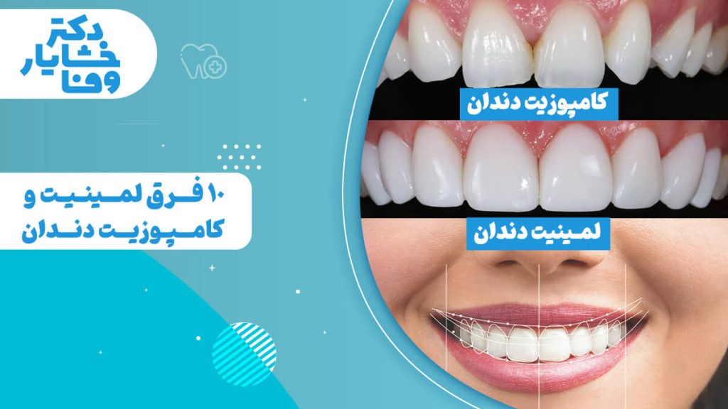 تصویری که تفاوت‌های لمینت و کامپوزیت دندان را نشان می‌دهد. در این تصویر، نمونه‌هایی از دندان‌های ترمیم‌شده با کامپوزیت و لمینت است.