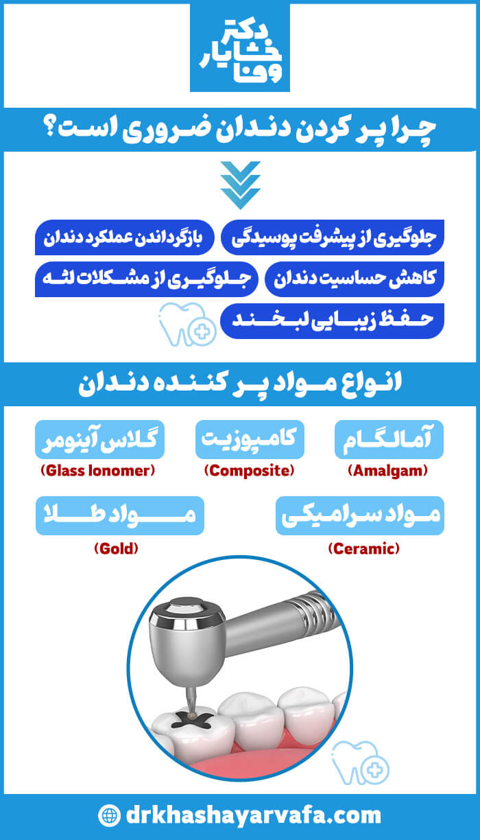 اینفوگرافیک چرا پر کردن دندان ضروری است و انواع مواد پر کننده دندان 