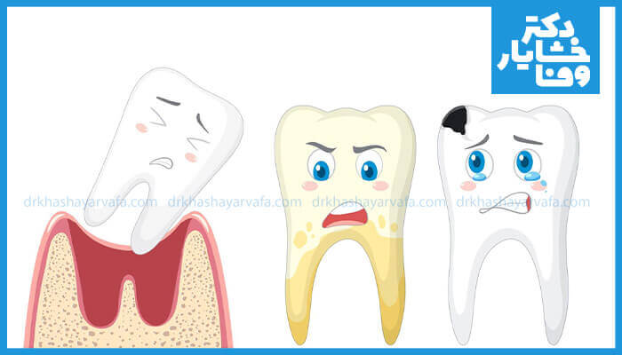 تصویری کارتونی از سه دندان که مراحل مختلف آسیب‌دیدگی دندان و لثه را نشان می‌دهد: دندانی که از لثه جدا شده، دندانی با جرم و تغییر رنگ، و دندانی با پوسیدگی شدید و حفره سیاه رنگ می‌باشد.
