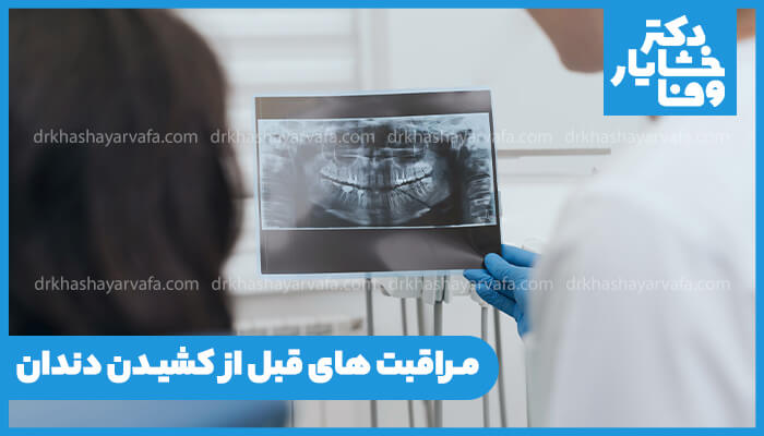 مراقبت‌های قبل از کشیدن دندان توسط دندانپزشک