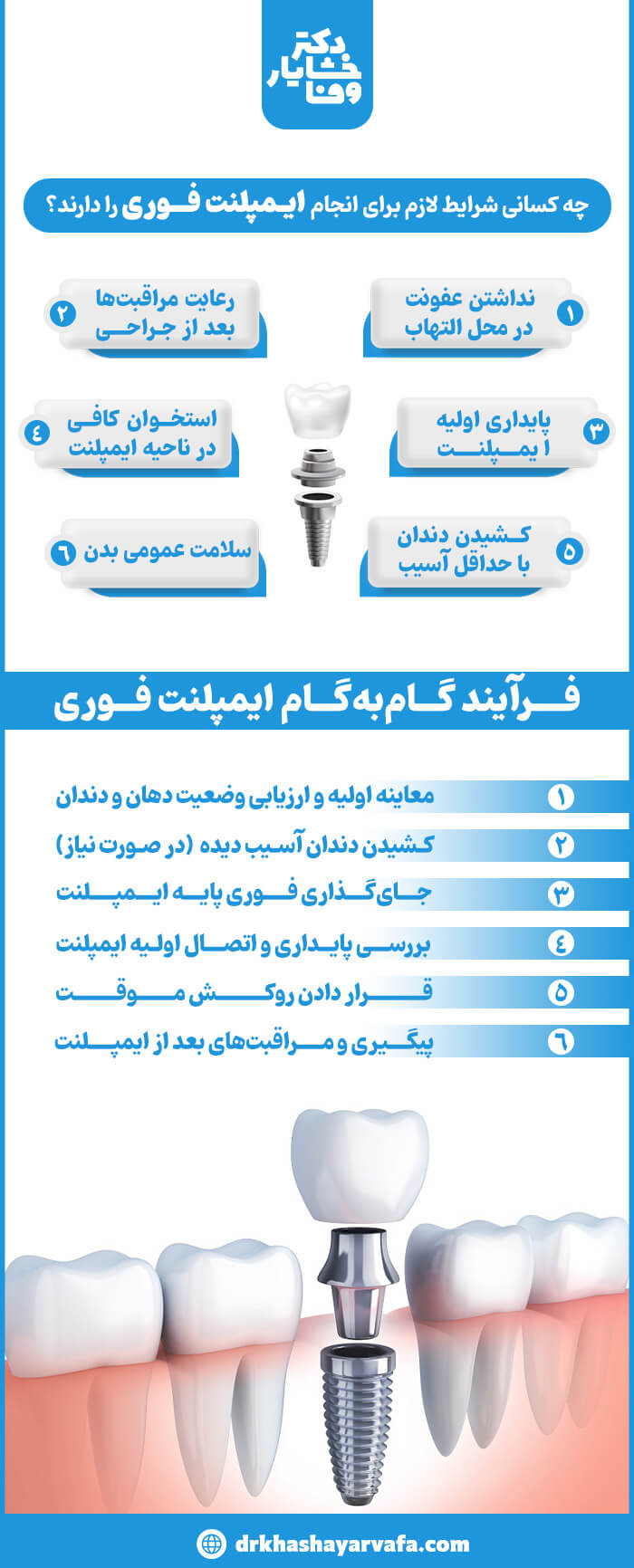 اینفوگرافیک جامع درباره ایمپلنت فوری دندان که شامل توضیحات "چه کسانی شرایط لازم برای انجام ایمپلنت فوری را دارند؟" (از جمله عدم عفونت، پایداری اولیه ایمپلنت، سلامت عمومی بدن و رعایت مراقبت‌ها) و "فرآیند گام‌به‌گام ایمپلنت فوری" (معاینه اولیه، کشیدن دندان، جایگذاری پایه ایمپلنت، بررسی پایداری، قرار دادن روکش موقت و پیگیری)