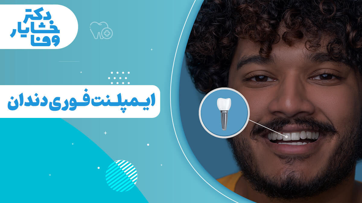 تصویر شاخص مردی با لبخند که دندان‌های سالم خود را نشان می‌دهد، با نمایی بزرگ‌شده از یک ایمپلنت فوری دندان که جایگزین دندان از دست رفته شده است. این تصویر مفهوم ایمپلنت دندان را به صورت بصری و جذاب نمایش می‌دهد.
