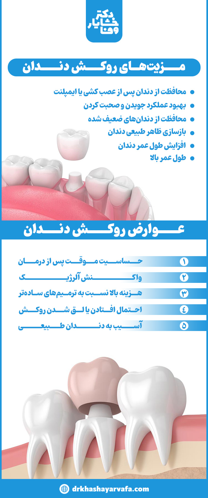 اینفوگرافیک جامع مزایا و عوارض روکش دندان، شامل محافظت از دندان، بهبود جویدن و حساسیت احتمالی دارد. 