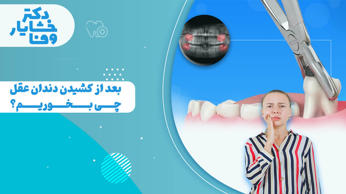 تغذیه بعد از کشیدن دندان عقل همراه با علائم درد و تصویر رادیوگرافی دندان عقل