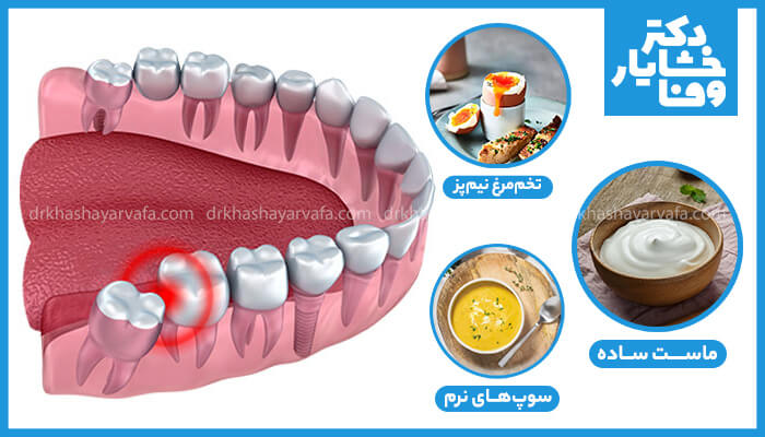 مواد غذایی مناسب بعد از کشیدن دندان عقل شامل تخم‌مرغ نیم‌پز، سوپ نرم و ماست ساده 