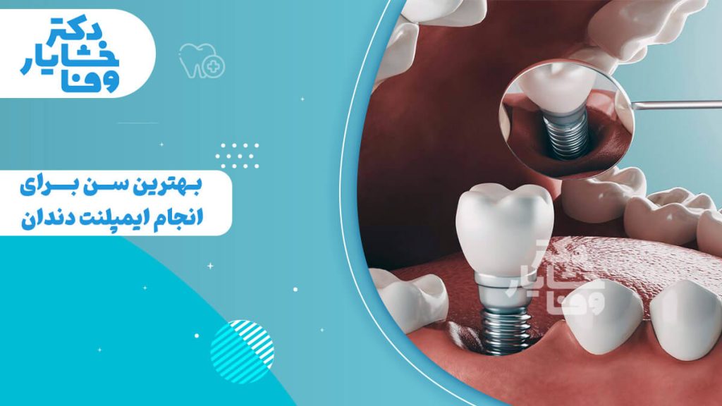 ایمپلنت دندان در دهان یک بیمار، همراه با متن "بهترین سن برای انجام ایمپلنت دندان چیست؟