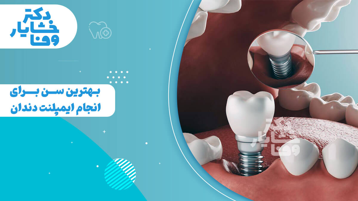 ایمپلنت دندان در دهان یک بیمار، همراه با متن "بهترین سن برای انجام ایمپلنت دندان چیست؟