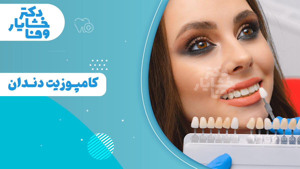 زنی جوان در صندلی دندانپزشکی در حال نگاه کردن به راهنمای رنگ دندان که توسط دندانپزشک گرفته شده است، با عنوان «کامپوزیت دندان» در تصویر.