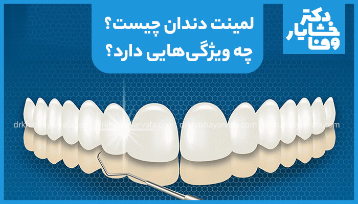 تصویر لمینت دندان و نحوه نصب آن روی دندان