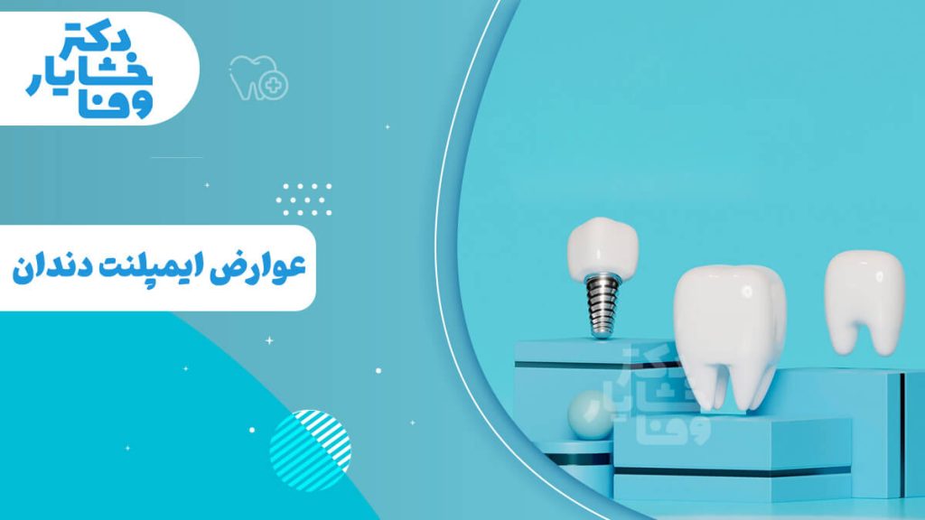 یک ایمپلنت کامل، یک روکش دندان و یک ایمپلنت بدون روکش را در پس‌زمینه آبی نشان می‌دهد.