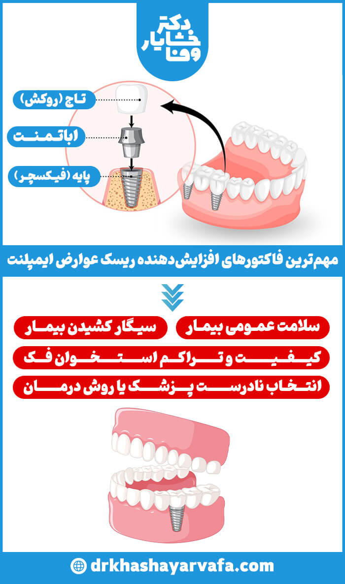 تصویر اینفوگرافیک با عنوان "مهمترین فاکتورهای افزایش دهنده ریسک عوارض ایمپلنت"، که ساختار ایمپلنت (پایه، اباتمنت، تاج) و عوامل خطرآفرین مانند سلامت عمومی، سیگار کشیدن، کیفیت استخوان فک و انتخاب پزشک را نشان می‌دهد.