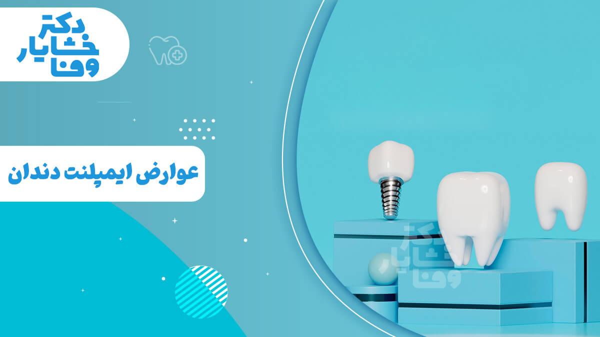 یک ایمپلنت کامل، یک روکش دندان و یک ایمپلنت بدون روکش را در پس‌زمینه آبی نشان می‌دهد.