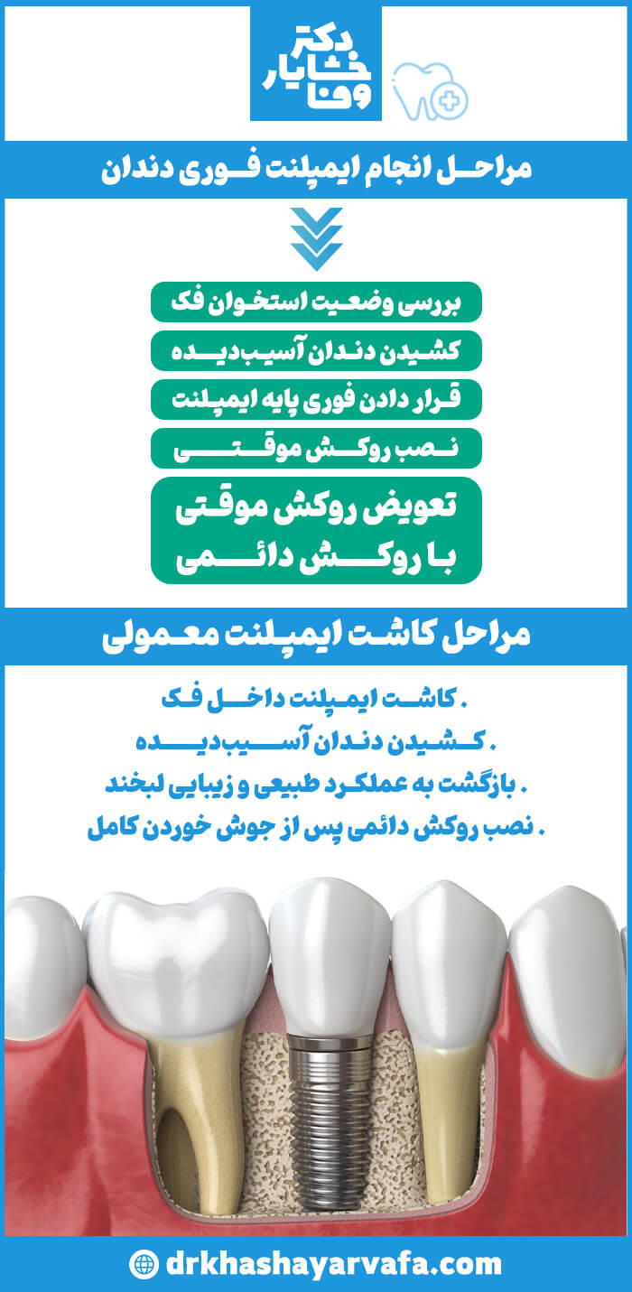 اینفوگرافیک مراحل انجام ایمپلنت فوری و ایمپلنت معمولی دندان را توضیح می‌دهد، شامل بررسی وضعیت استخوان، کشیدن دندان، کاشت پایه، و نصب روکش‌های موقت و دائم.