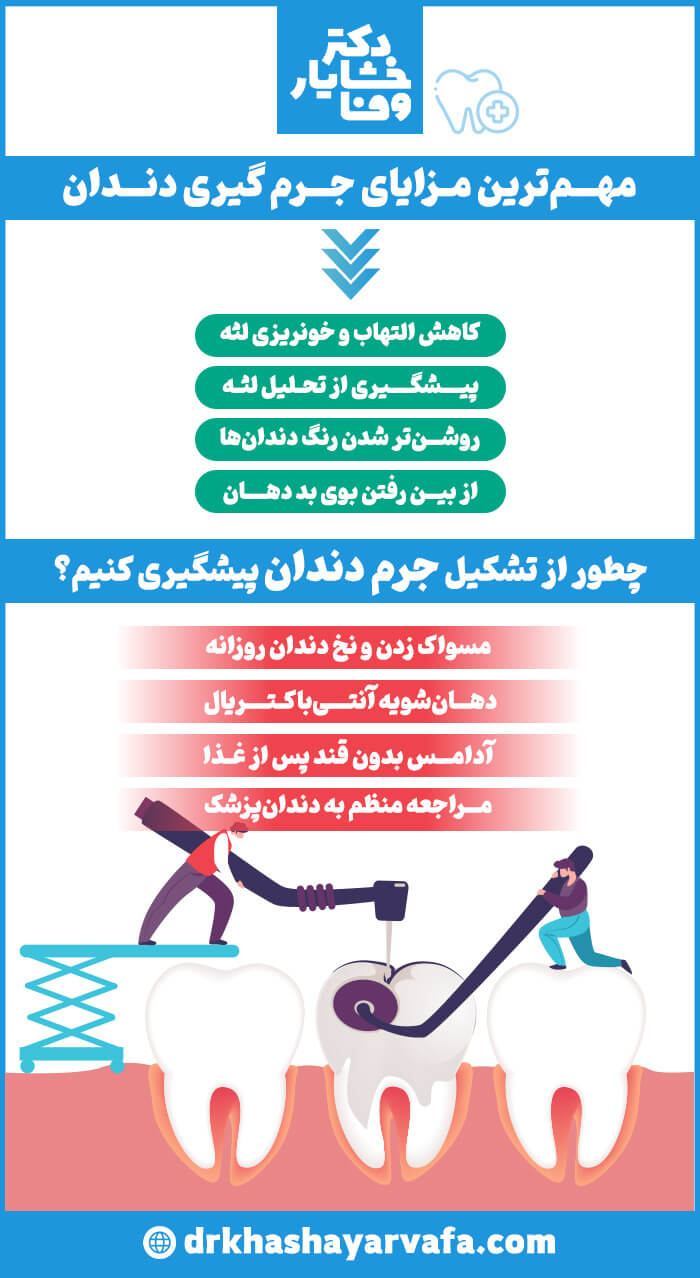  اینفوگرافیک با عنوان "مهم‌ترین مزایای جرم‌گیری دندان" و "چطور از تشکیل جرم دندان پیشگیری کنیم؟" که مزایا و روش‌های پیشگیری را به صورت تصویری و متنی توضیح می‌دهد.