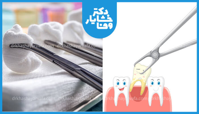 ابزارهای دندانپزشکی و گاز استریل در کنار تصویر کارتونی دندان کشیده شده و دندانهای سالم.