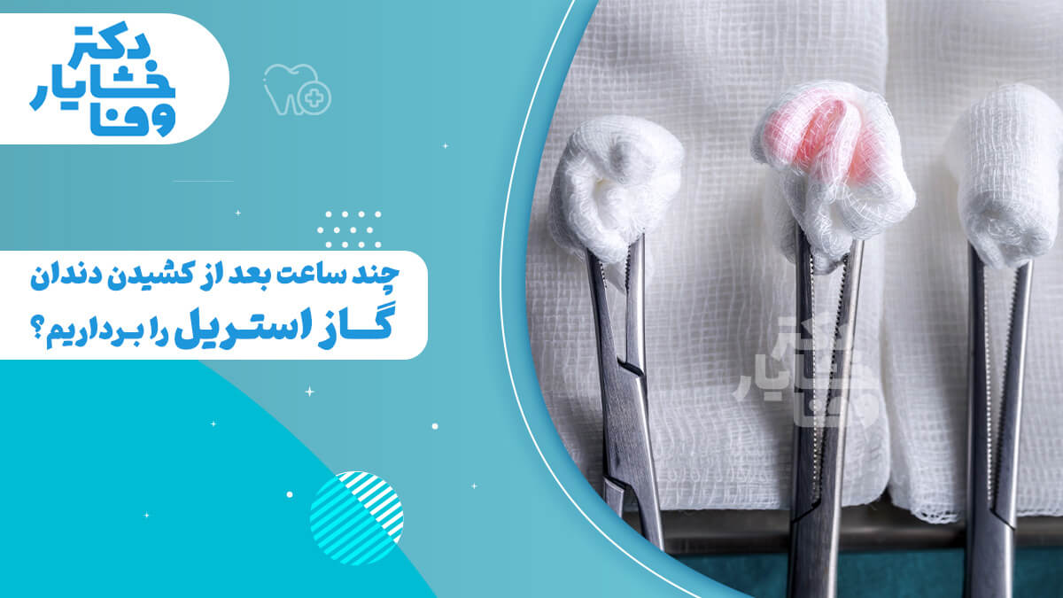 ابزارهای دندانپزشکی و گاز استریل با عنوان "چند ساعت بعد از کشیدن دندان گاز استریل را برداریم؟