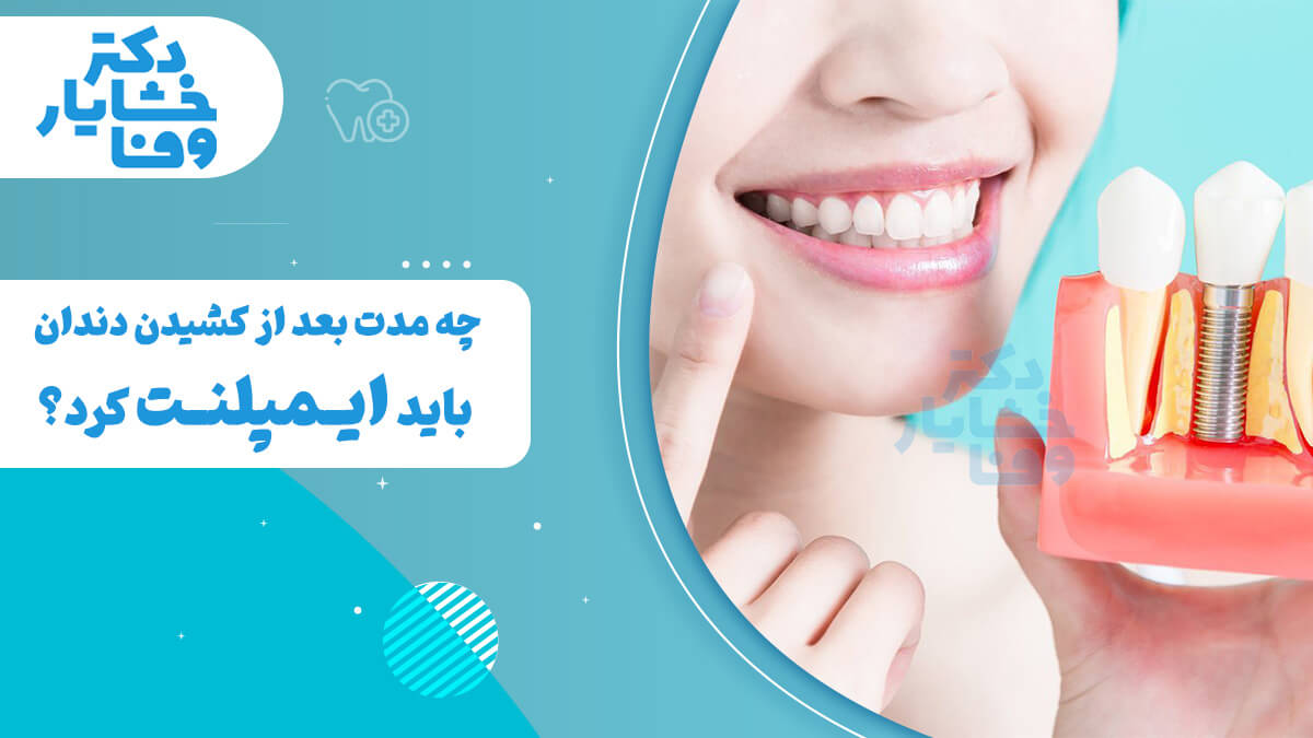 یک زن خندان که مدل مقطعی از یک دندان و ایمپلنت را در دست دارد. متن فارسی روی تصویر می‌پرسد: "چه مدت بعد از کشیدن دندان باید ایمپلنت کرد؟" این تصویر به موضوع زمانبندی کاشت ایمپلنت دندان اشاره دارد.