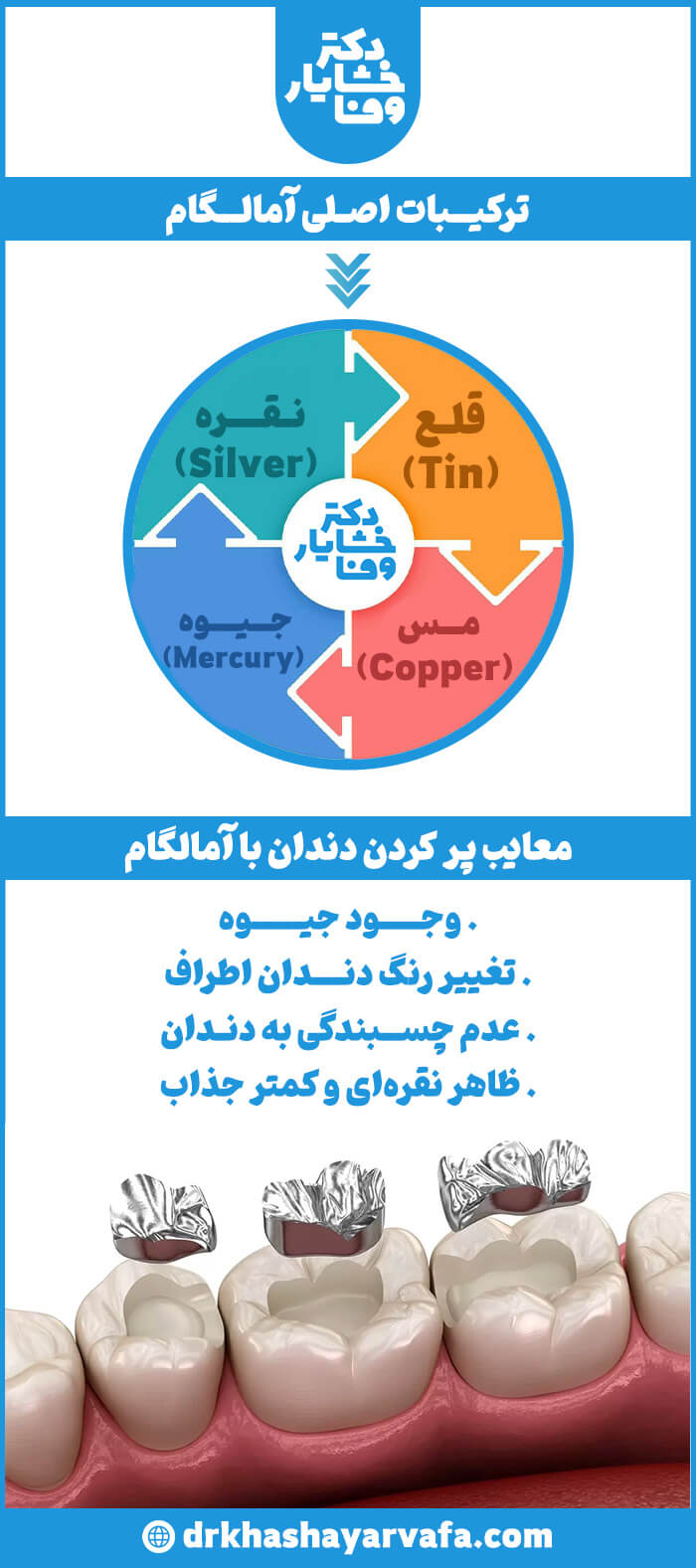 اینفوگرافیک ترکیبات اصلی و معایب پر کردن دندان با آمالگام. شامل نقره، قلع، جیوه، و مس و همچنین معایب آن مانند تغییر رنگ و ظاهر نقره‌ای