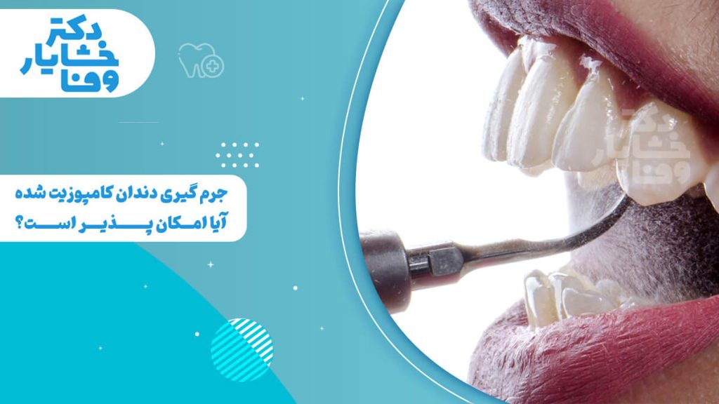 تصویر مقایسه‌ای از دندانپزشک در حال جرم‌گیری دندان کامپوزیت شده.