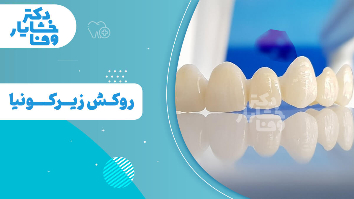 در سمت راست، نمونه‌ای از روکش‌های دندان زیرکونیا نشان داده شده است.