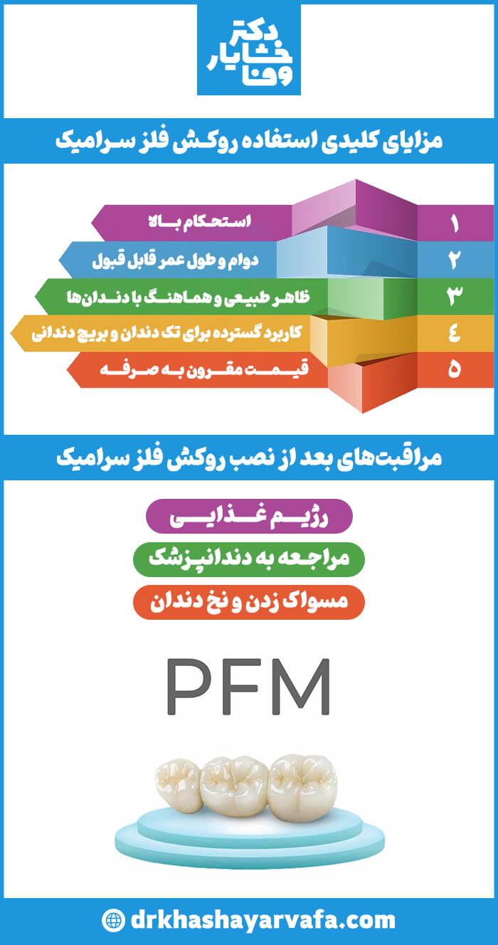  یک اینفوگرافیک با موضوع مزایا و مراقبت‌های بعد از روکش دندان PFM. بخش بالایی با عنوان "مزایای کلیدی استفاده روکش فلز سرامیک" شامل ۵ مورد است: استحکام بالا، دوام و طول عمر قابل قبول، ظاهر طبیعی، کاربرد گسترده و قیمت مقرون به صرفه. بخش پایینی نیز با عنوان "مراقبت‌های بعد از نصب روکش فلز سرامیک" شامل سه مورد است: رژیم غذایی، مراجعه به دندانپزشک و مسواک زدن و نخ دندان.