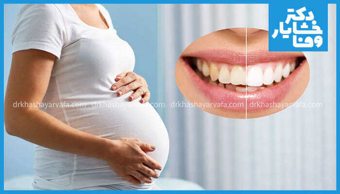 تصویری ترکیبی از یک زن باردار که شکمش را در آغوش گرفته و نمایی از یک دهان که دندانهای آن به صورت قبل و بعد از سفید کردن (زرد و سفید) نمایش داده شده است.