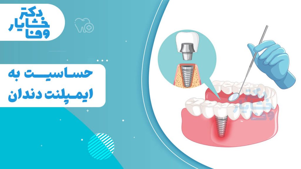 تصویر گرافیکی با موضوع "حساسیت به ایمپلنت دندان" و نمایش یک ایمپلنت کاشته شده در مدل فک