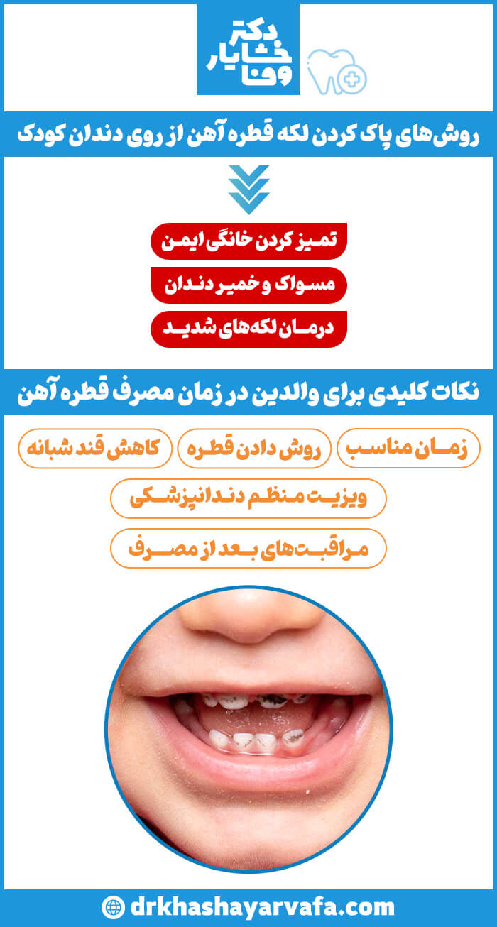 اینفوگرافیک روش‌های پاک کردن لکه قطره آهن از روی دندان کودک و نکات کلیدی برای والدین در زمان مصرف آهن