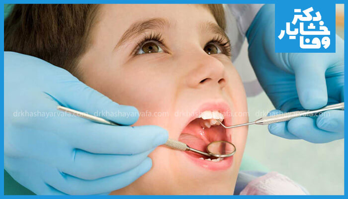 عکس معاینه دندان‌های کودک توسط دندانپزشک اطفال با استفاده از آینه و پروب دندانپزشکی.