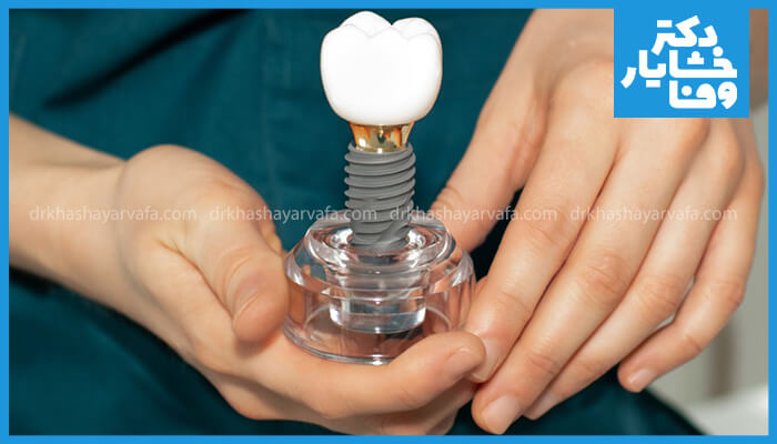 نمای نزدیک از یک مدل ایمپلنت دندان کامل (پیچ، اباتمنت و روکش) که توسط دستان یک فرد نگه داشته شده است.