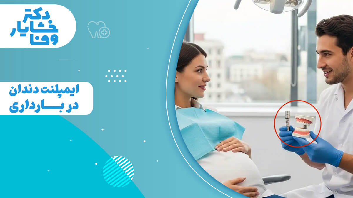 مشاوره ایمپلنت دندان برای زن باردار، نمایش مدل ایمپلنت توسط دندانپزشک متخصص