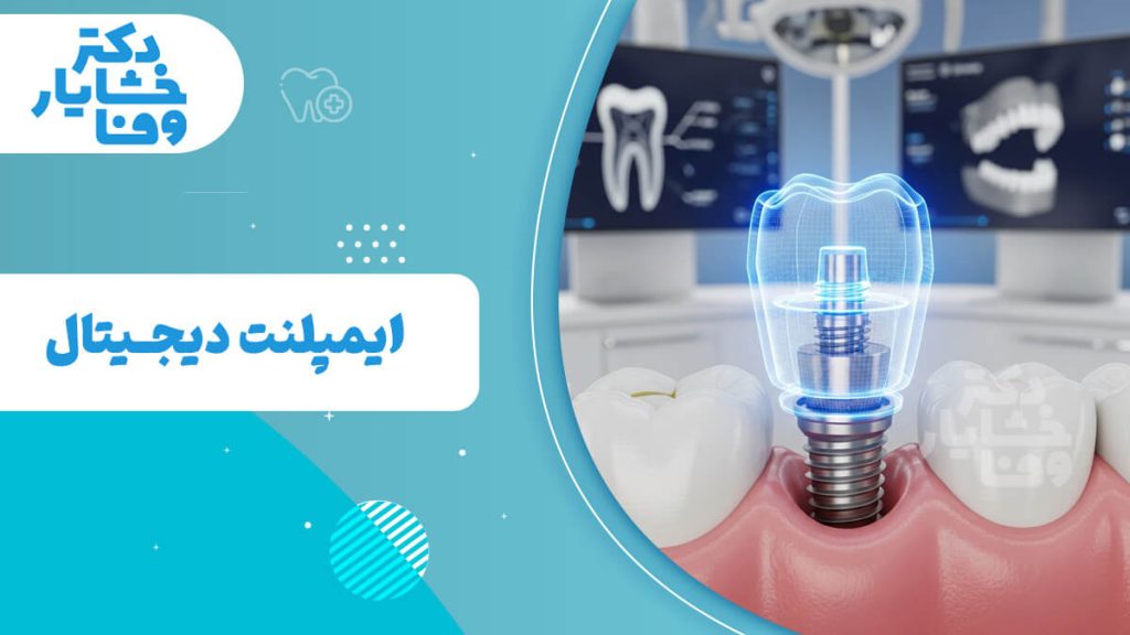بنر آبی و سفید با عنوان "ایمپلنت دیجیتال" و تصویر شفاف سه‌ بعدی از یک ایمپلنت دندان کاشته شده در لثه.