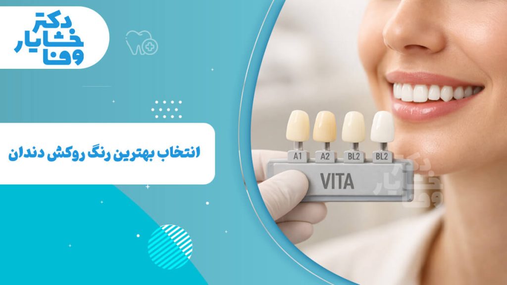 انتخاب بهترین رنگ روکش دندان که در کنار آن، دستکش دندانپزشک در حال نگه‌داشتن راهنمای رنگ VITA با شیدهای A1، A2 و BL2 است.