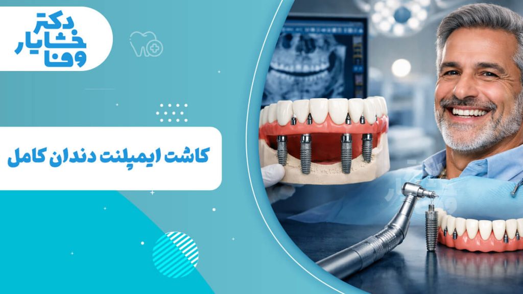 لبخند رضایت‌ بخش یک مرد میانسال که مدل ایمپلنت دندان کامل (All-on-4) را در دست دارد و نتیجه دائمی و زیبایی این روش را نشان می‌دهد.