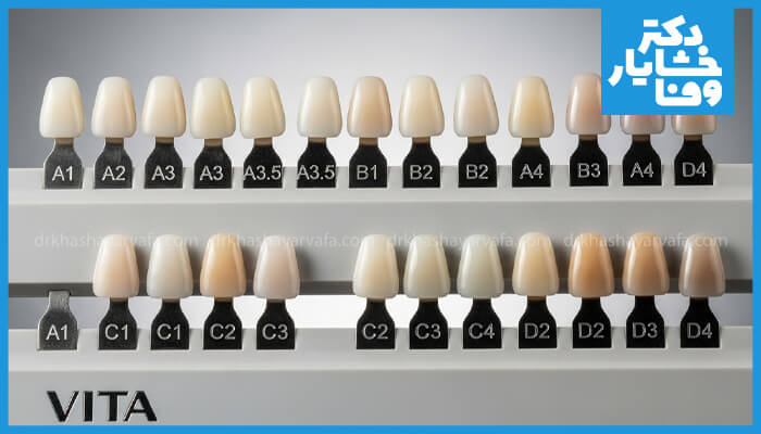 نمای نزدیک از یک راهنمای رنگ دندان VITA کلاسیک که مجموعهای از سایههای مختلف دندان (A1 تا D4) را در دو ردیف نشان میدهد.