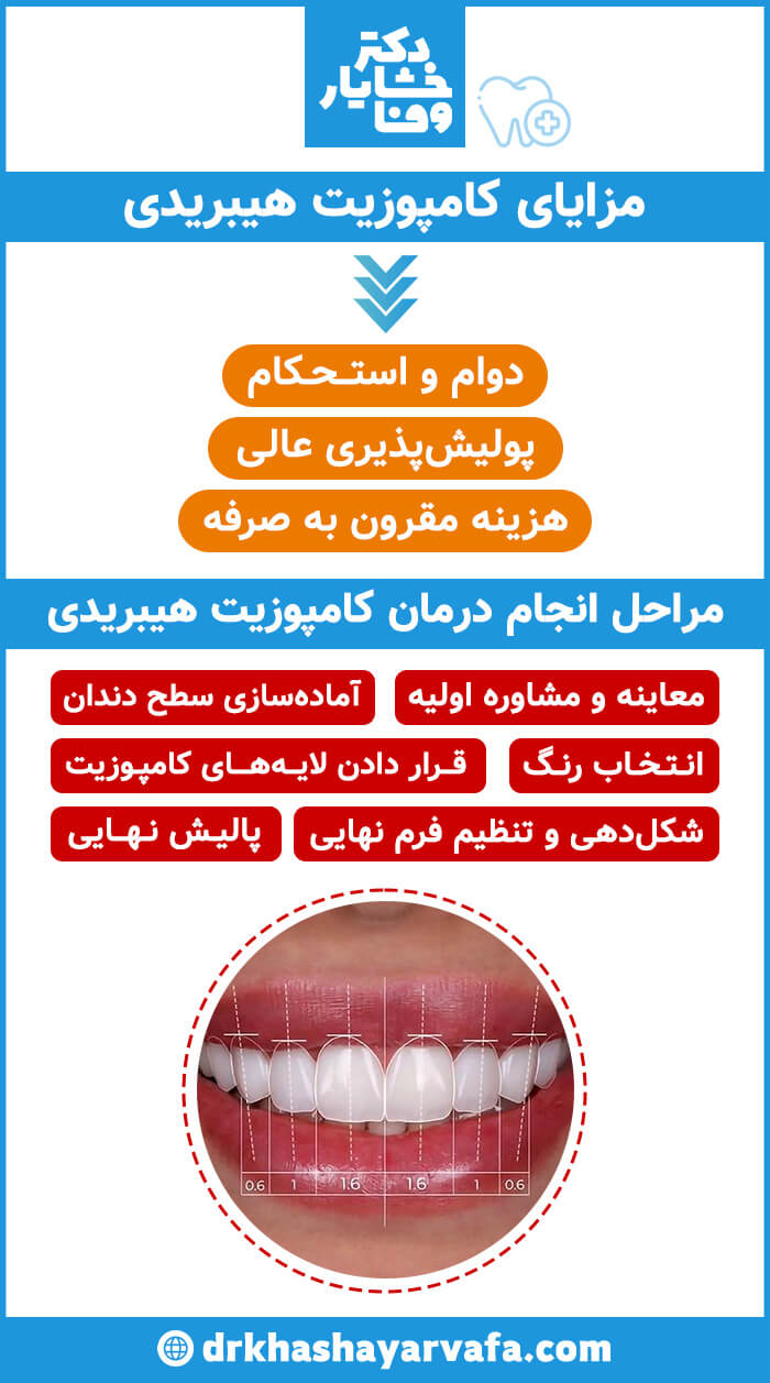 اینفوگرافیک مراحل و مزایای کامپوزیت هیبریدی شامل: دوام، پولیش‌پذیری عالی، هزینه مقرون به صرفه و مراحل درمانی (معاینه تا پالیش نهایی).
