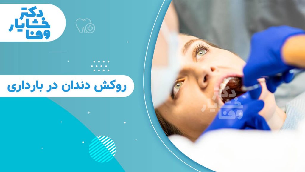 نمای نزدیک از یک زن در حال دریافت خدمات دندانپزشکی، با تمرکز بر دهان و دستکش‌های پزشک. عنوان فارسی: "روکش دندان در بارداری".