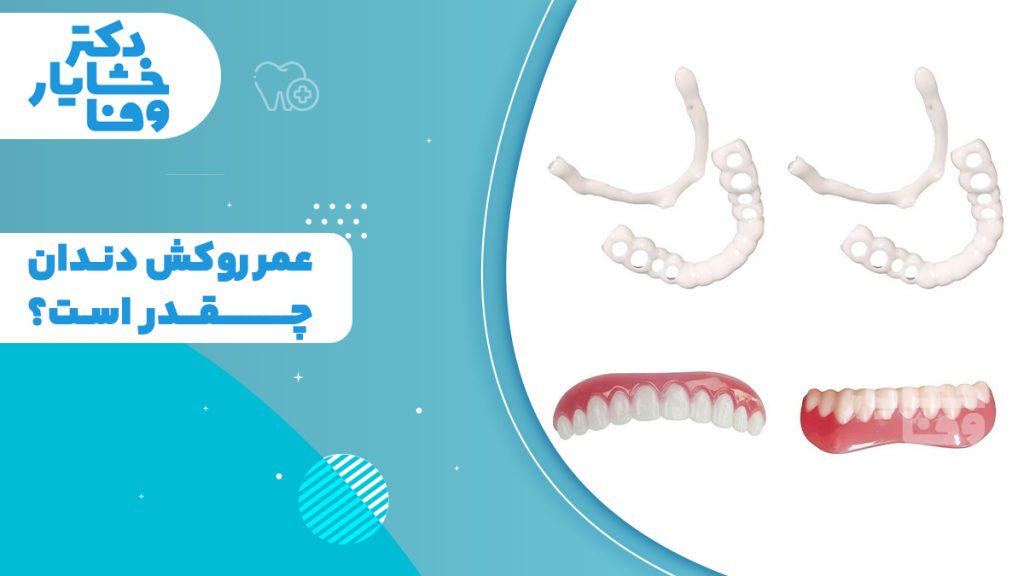 انواع روکش و پروتز دندان و بررسی اینکه عمر روکش دندان چقدر است