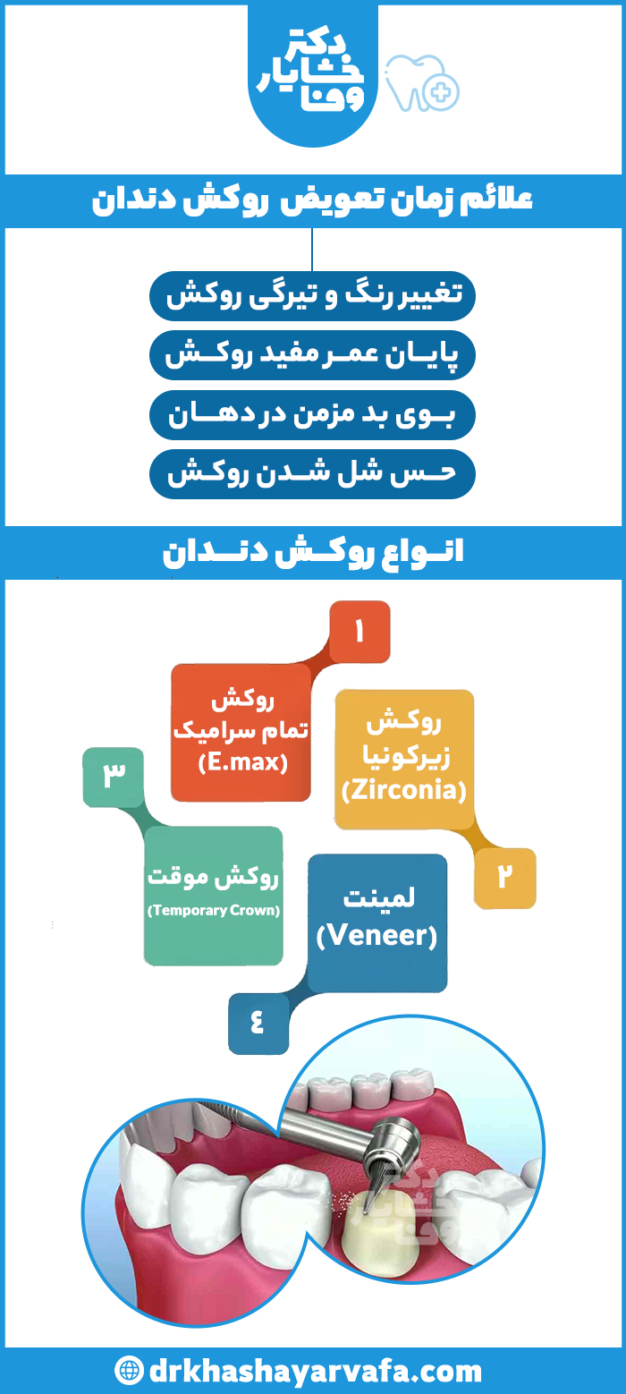 اینفوگرافیک علائم زمان تعویض روکش دندان و معرفی انواع روکش دندان شامل زیکونیا، تمام سرامیک، لمینت و موقت