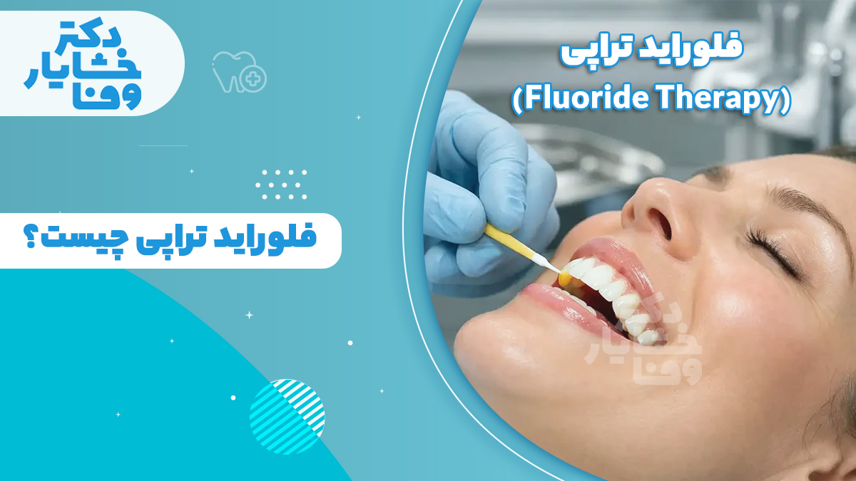 فلورایدتراپی برای یک خانم در مطب دندانپزشکی