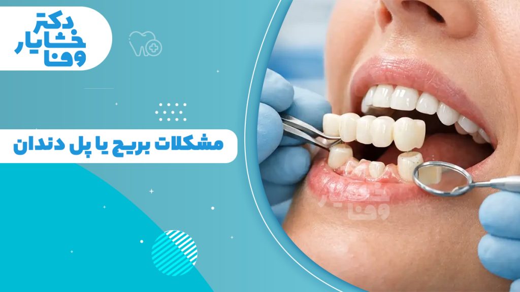 معایب و مشکلات بریج دندان در هنگام معاینه؛ بررسی پوسیدگی زیر بریج و التهاب لثه