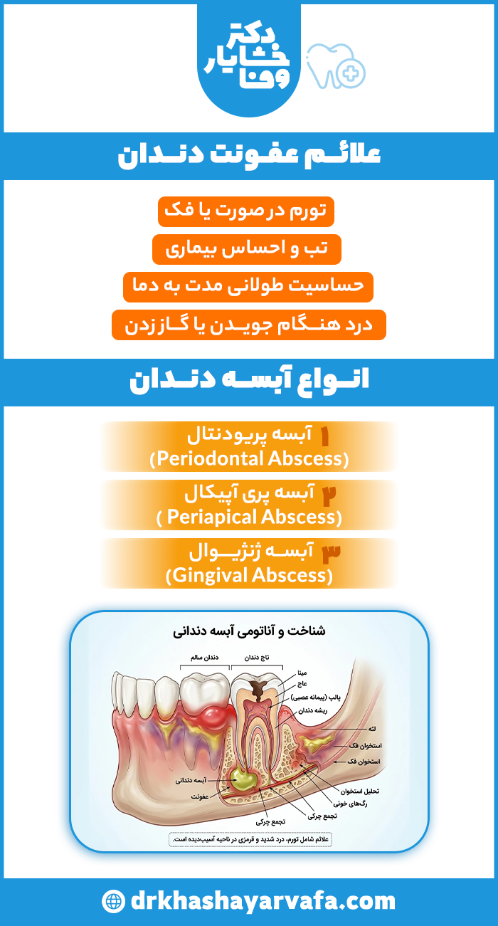 اینفوگرافیک علائم عفونت دندان و انواع آبسه دندان شامل آبسه پریودنتال، پری‌آپیکال و لثه‌ای همراه با تصویر آناتومی دندان